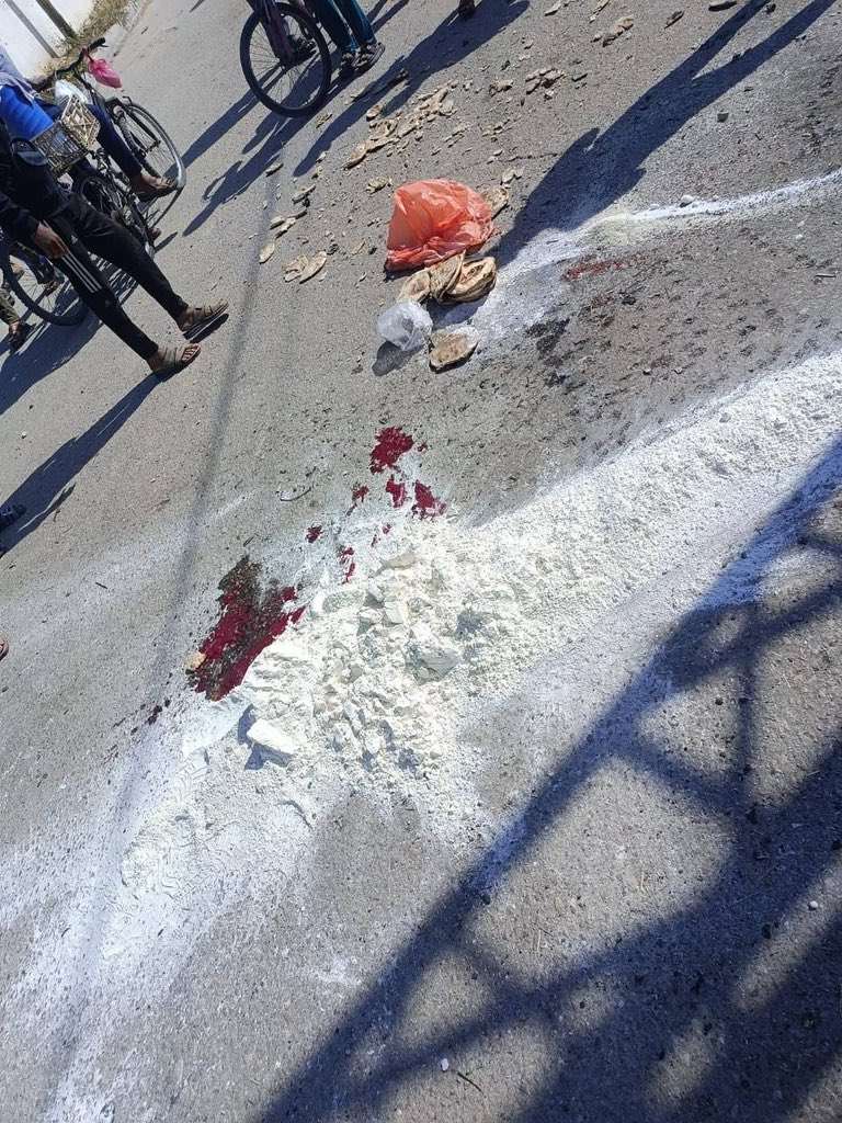 Civilians Wounded in Israeli Bombing Near Khan Younis
