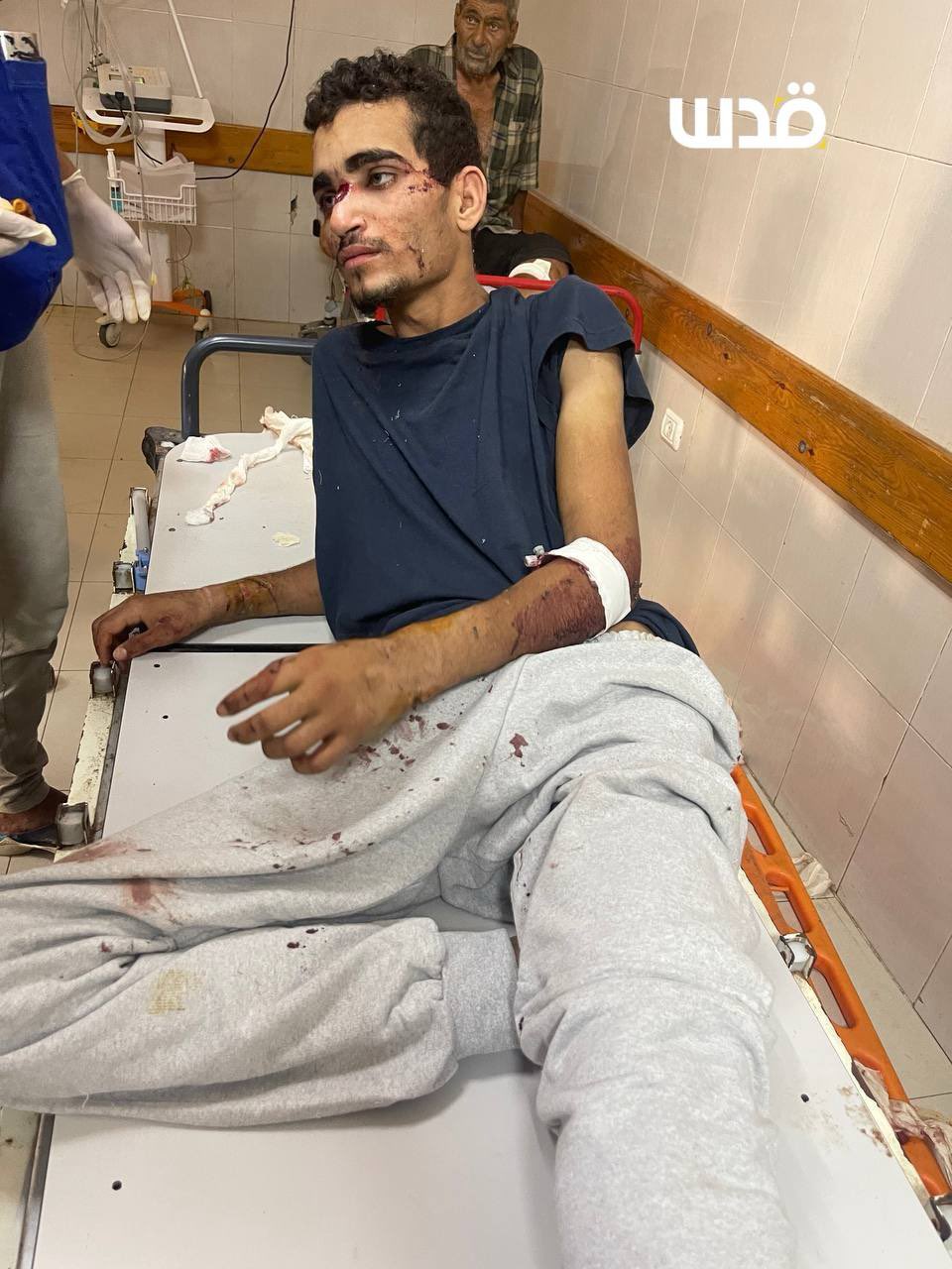 Palestinian Prisoner Loses Memory After Torture in Israeli Detention