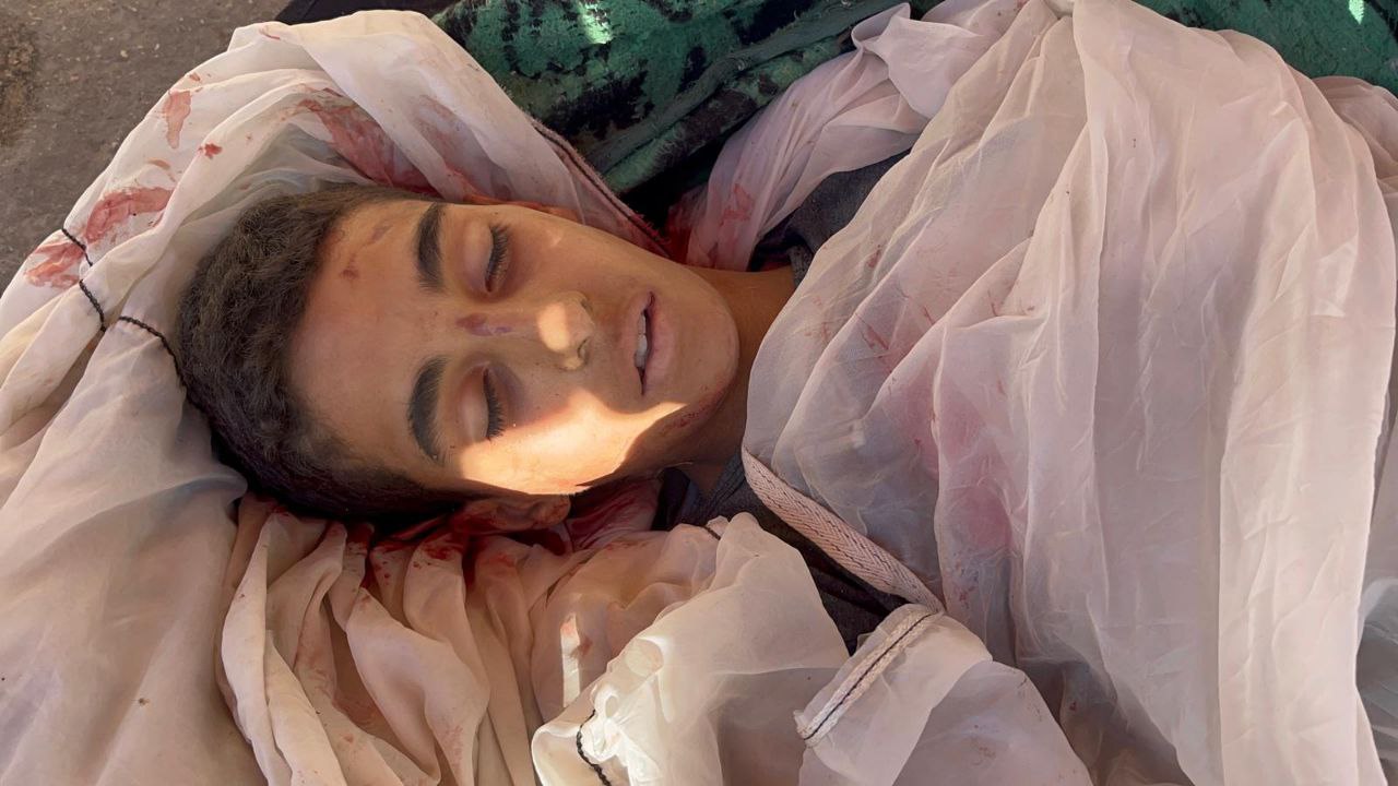 Children Shot While Accessing Food Aid Distribution Point
