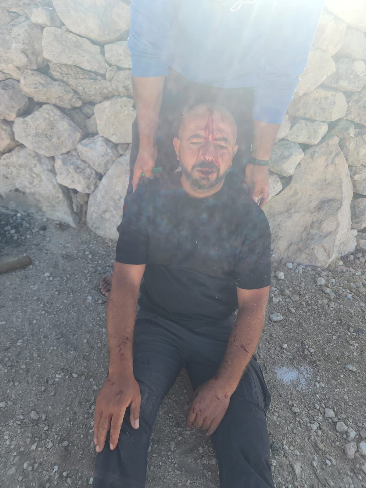 Palestinian wounded in Israeli attack on Masafer Yatta