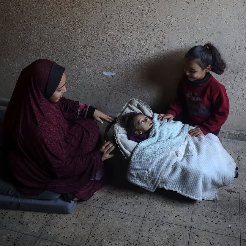 Mother and malnourished child in Deir al-Balah shelter