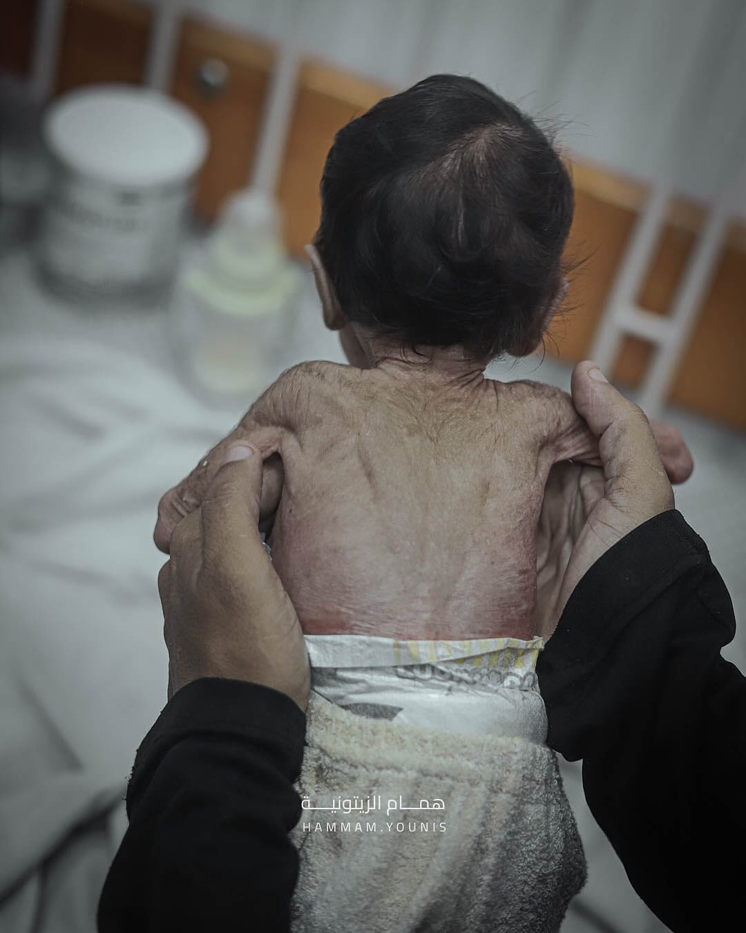 Gaza reports 10 deaths from hunger and malnutrition in 24 hours