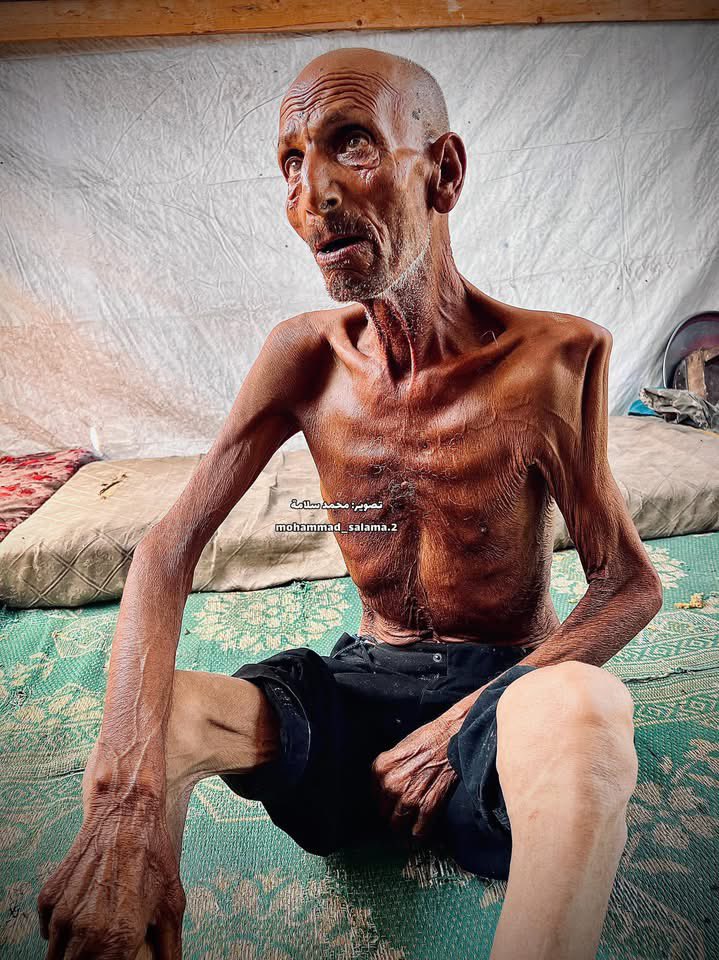 Elderly Man Claims No Bread for Five Days