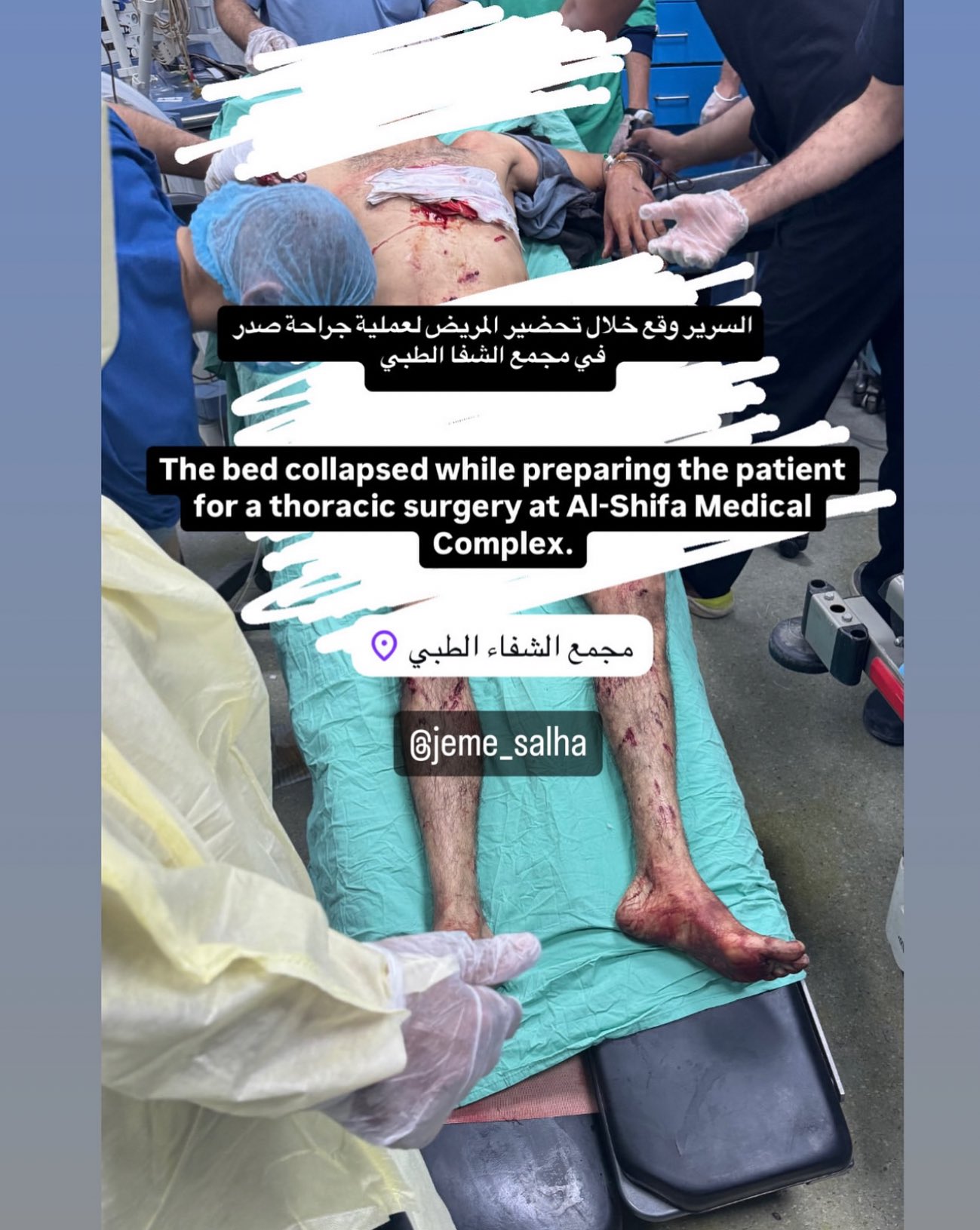 Gaza’s Healthcare System Collapse: Patient Falls During Surgery at Al-Shifa Hospital