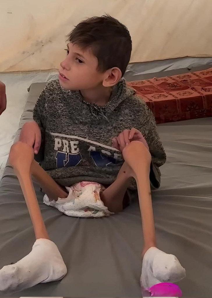 Children of Gaza Face Famine Amid Ongoing Bombardment