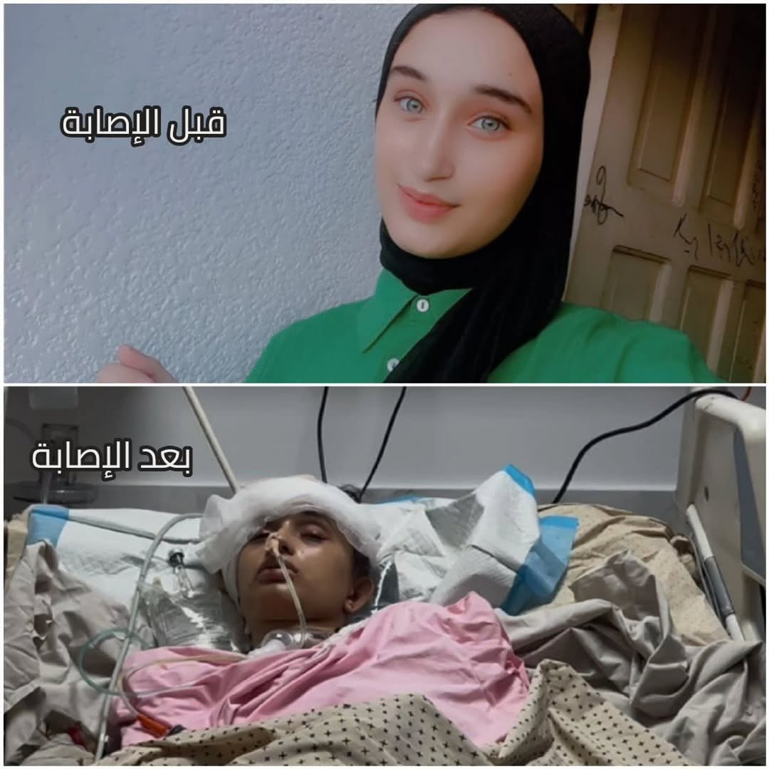 18-year-old student critically injured by shrapnel in Gaza bombing