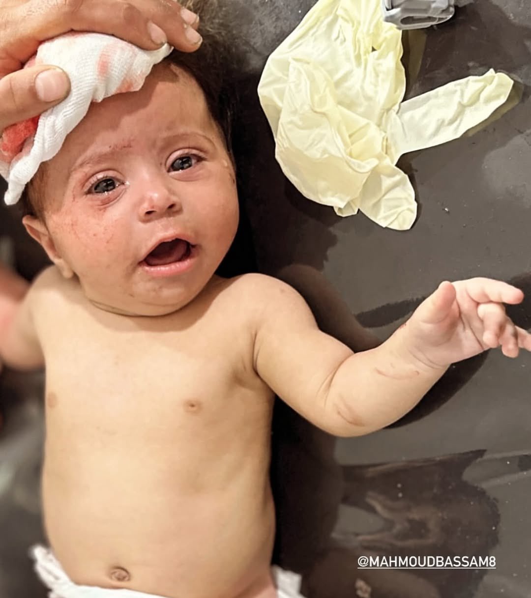 Injured infant cries after Israeli airstrike targets Gaza home