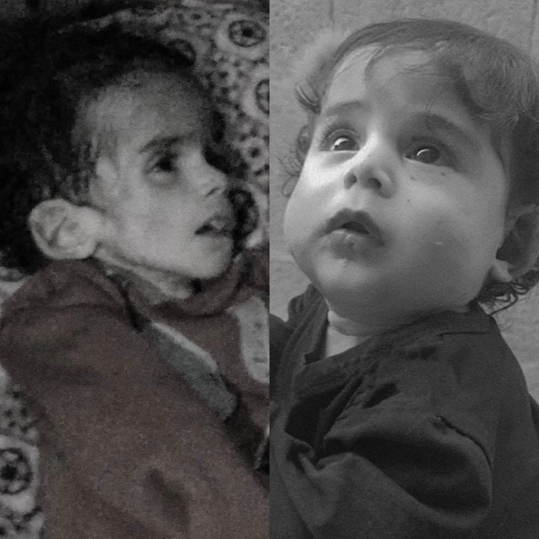 Anhar Saqr Al-Shanbari starved to death in Gaza