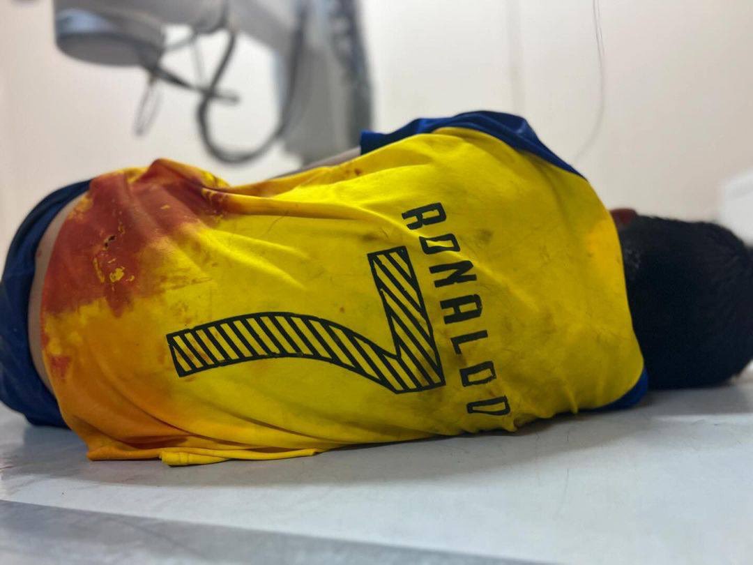 Child injured in Israeli airstrike near Deir Al Balah