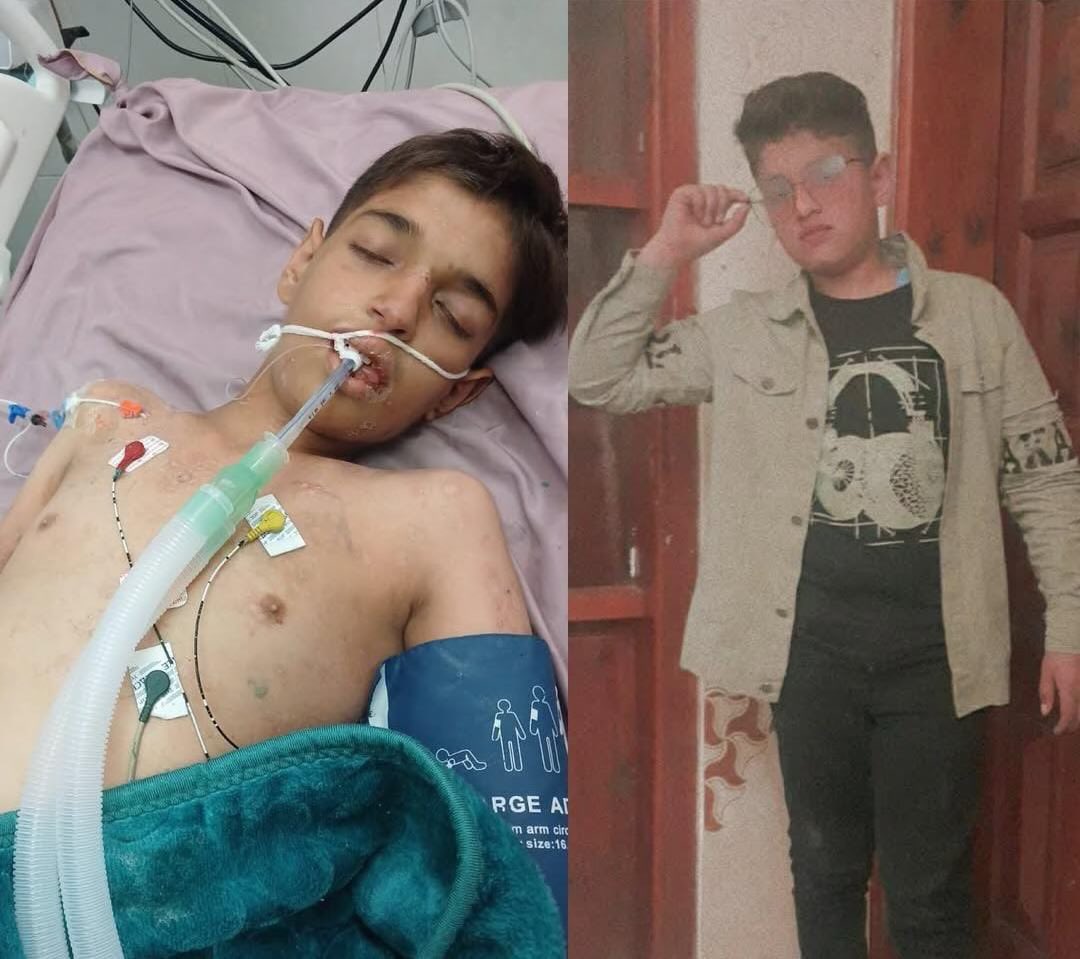 Gaza children suffer from abandonment, siege, and world silence