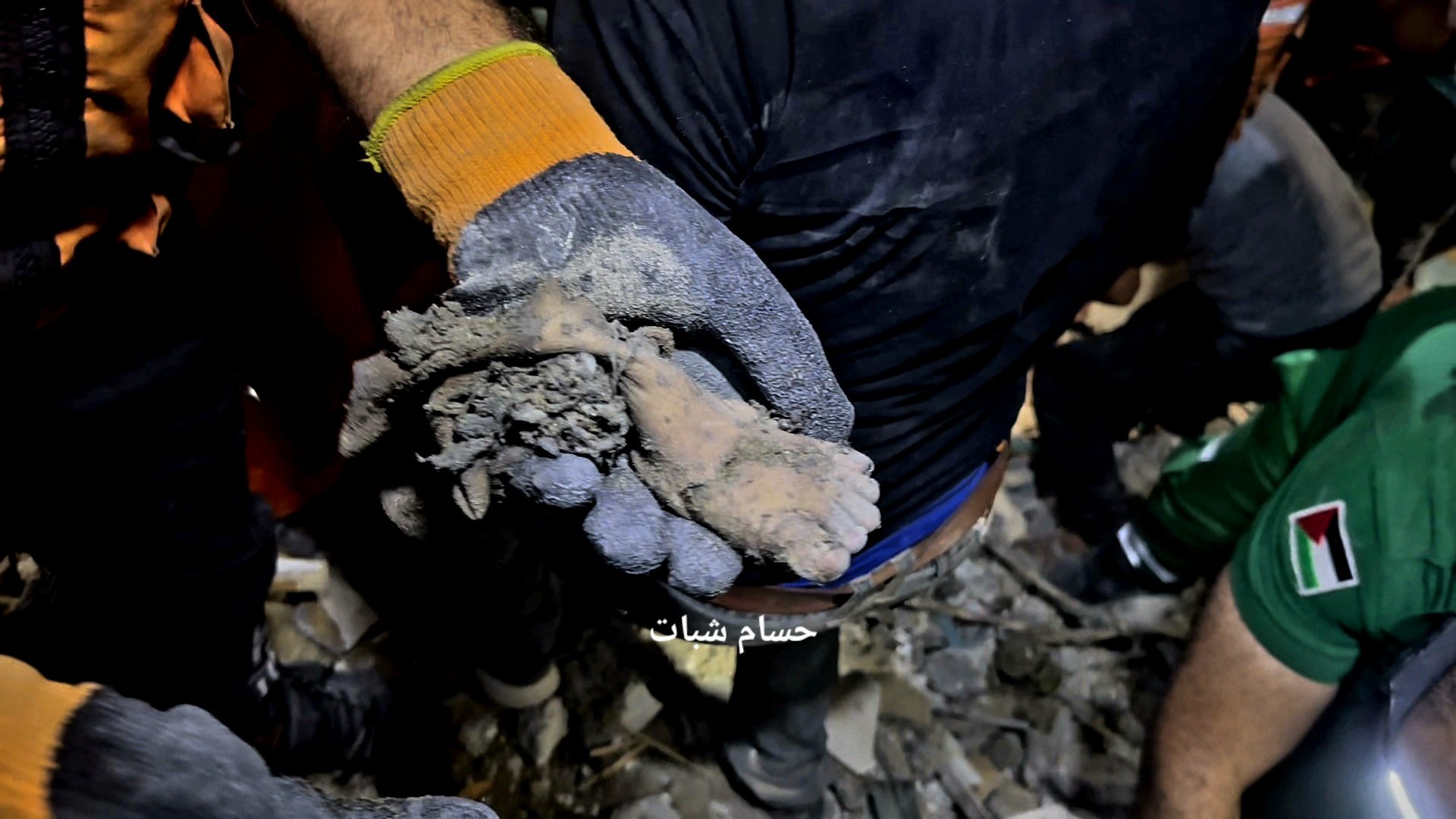 Child victim of explosive violence in conflict zone