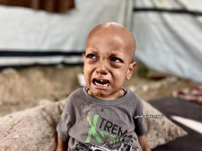 Child Death from Starvation in Gaza Amid Crisis