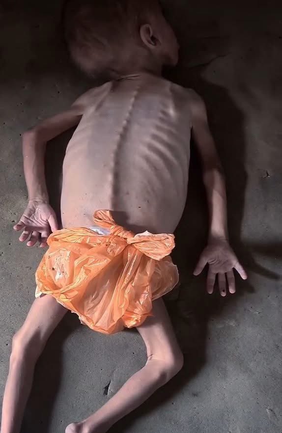 Humanitarian Crisis: Shortages of Food and Diapers Under Occupation