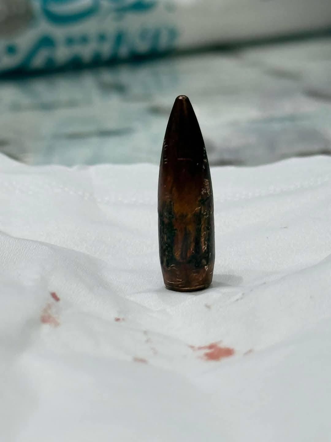 Egyptian doctors remove bullet from Palestinian woman’s skull