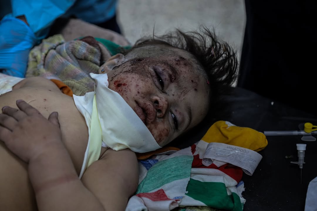 Child Survives Gaza Massacre Losing 27 Family Members