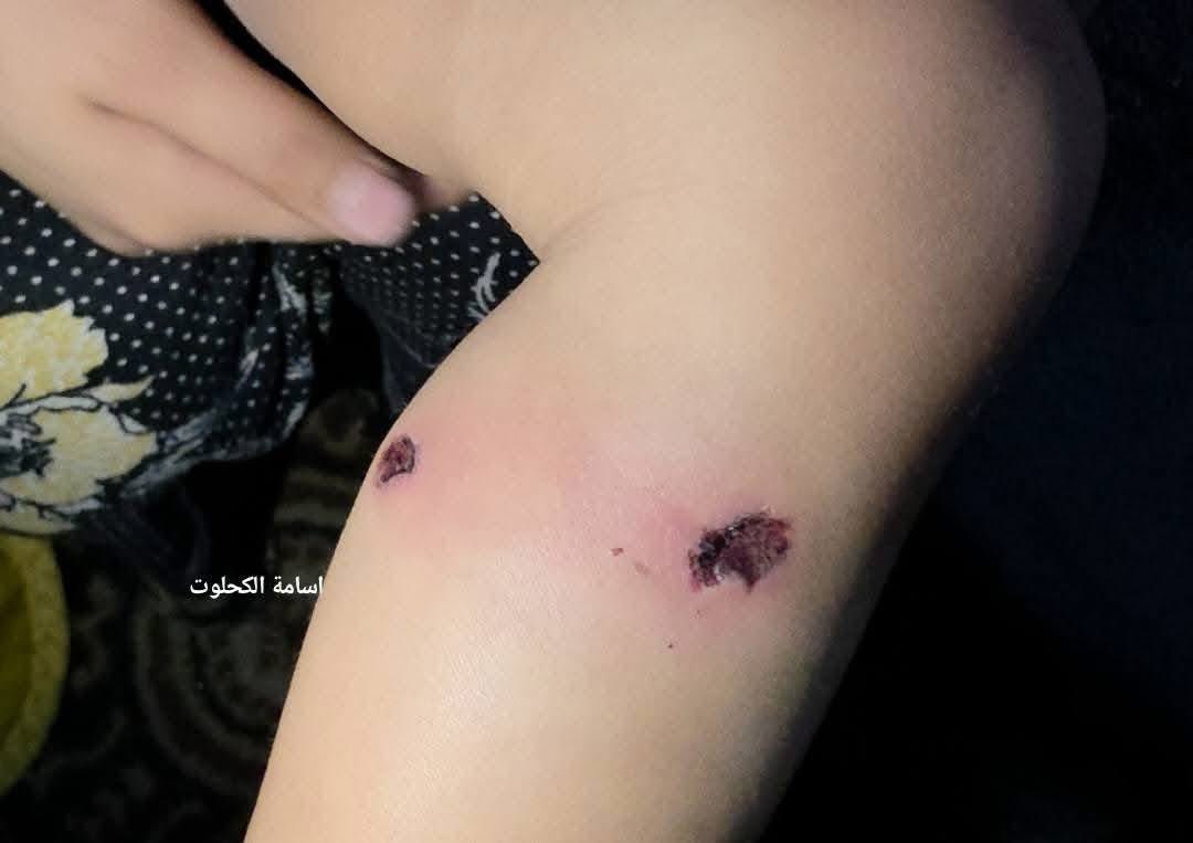 Israeli forces accused of detaining and torturing toddler in Gaza