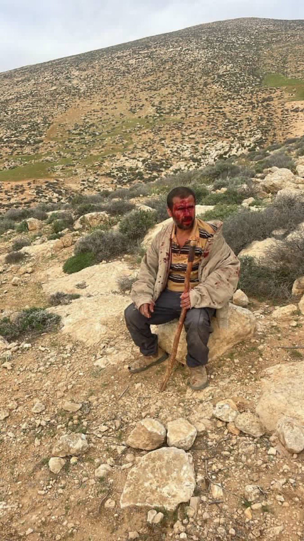 Palestinian Shepherds Attacked by Settler Militias in Masafer Yatta