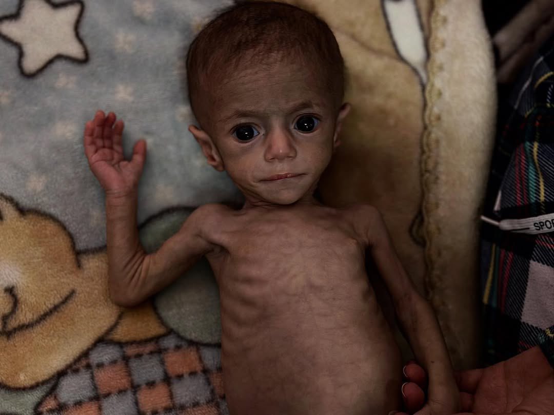 Plea Against Siege and Starvation