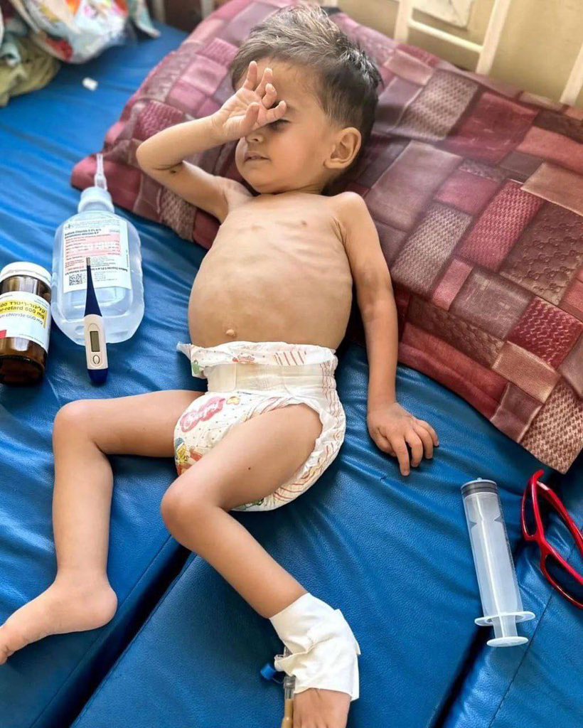 Famine in North Gaza: Global Response Question