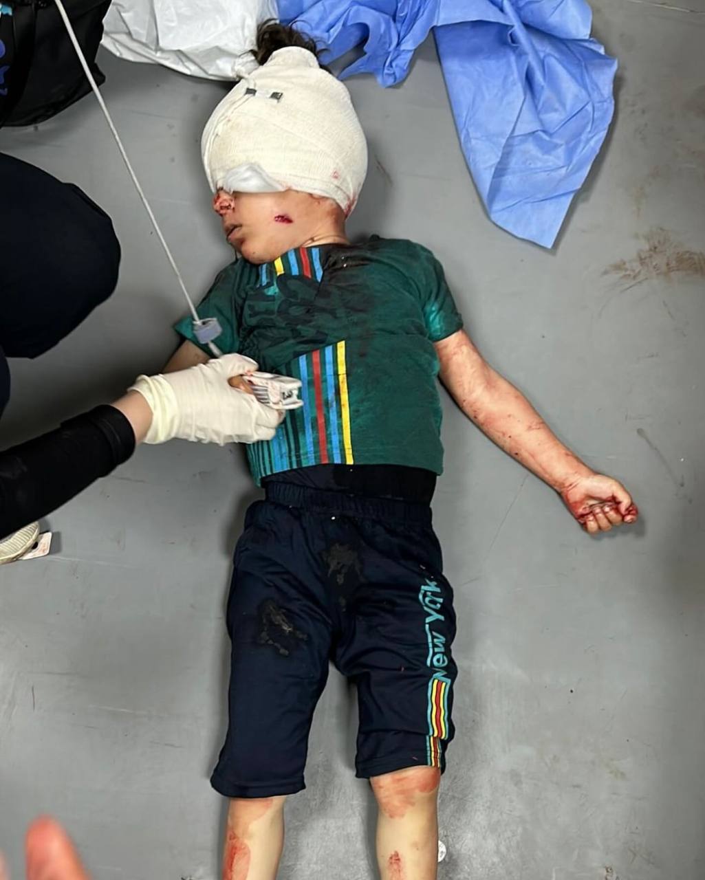 Israeli occupation commits 6 massacres killing 79 in 24 hours