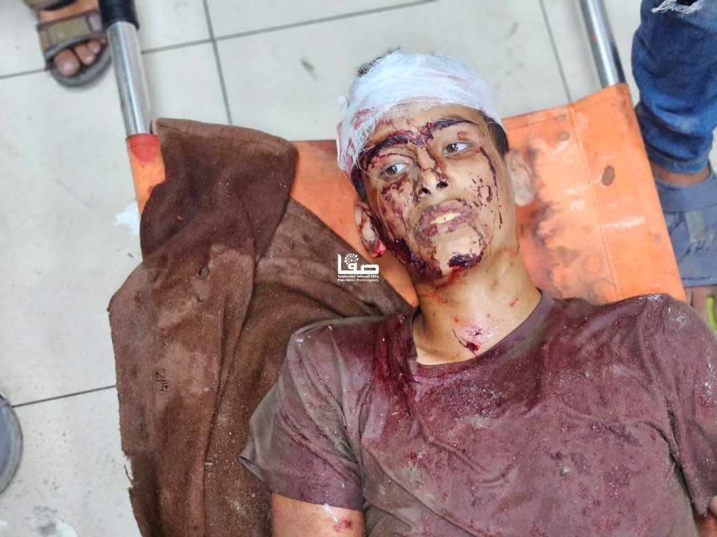 Israeli forces kill aid seekers in Gaza clash