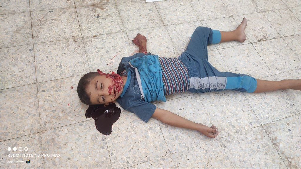 Nine killed, eighteen injured in Israeli bombing of school shelter