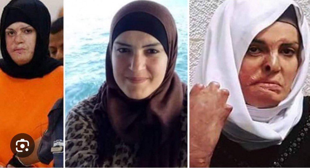 Palestinian Mother Shot and Arrested in Conflict Incident