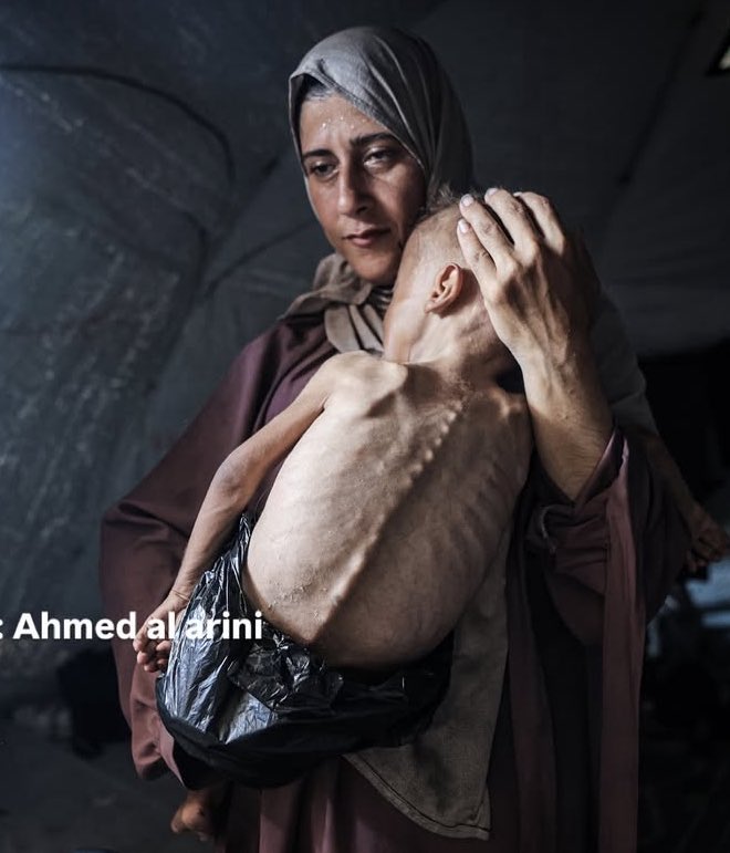 Humanitarian Crisis: Calls to Open Crossings and Lift Siege