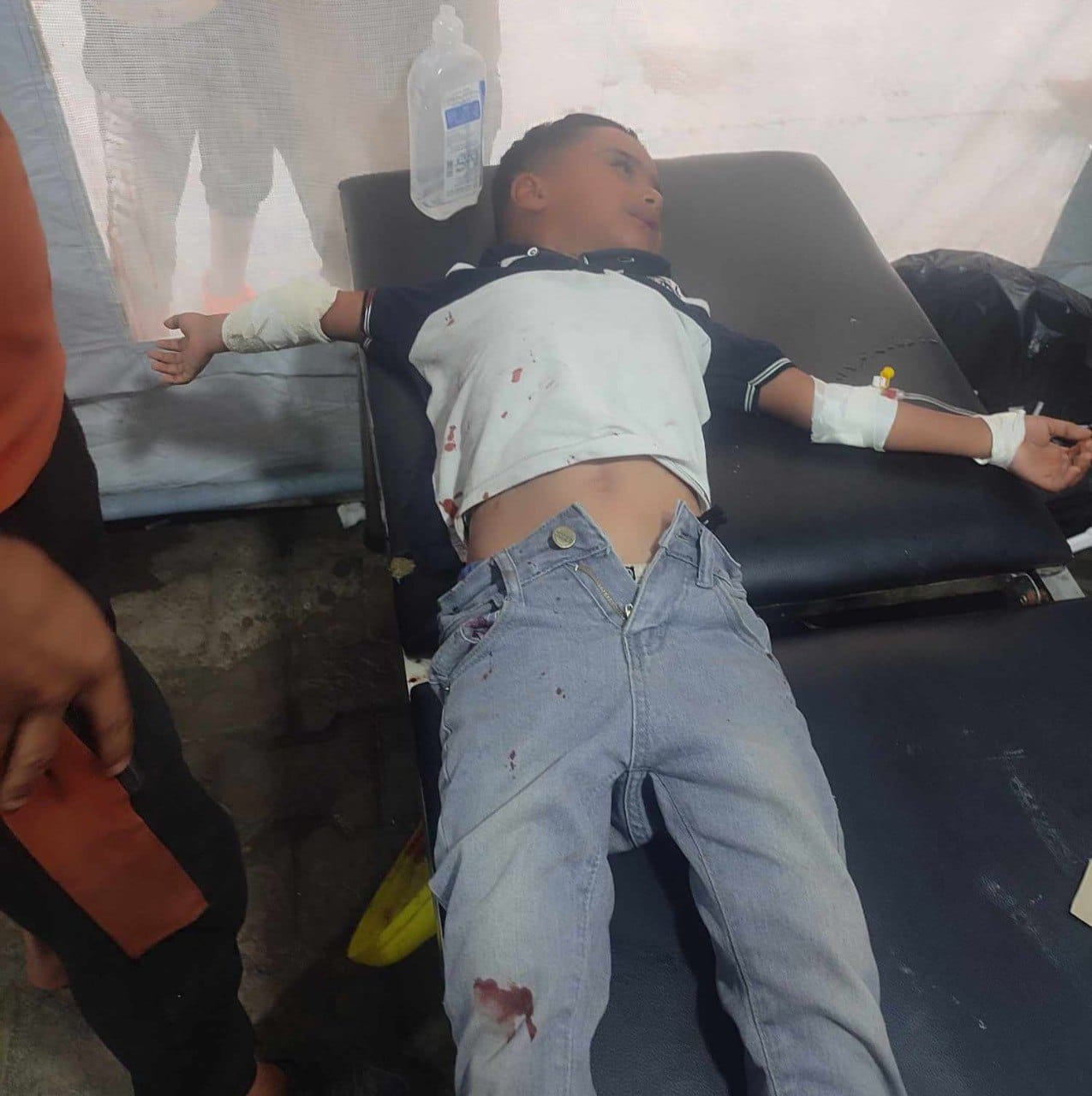 Palestinian Child Injured in Israeli Drone Strike on Gaza Market