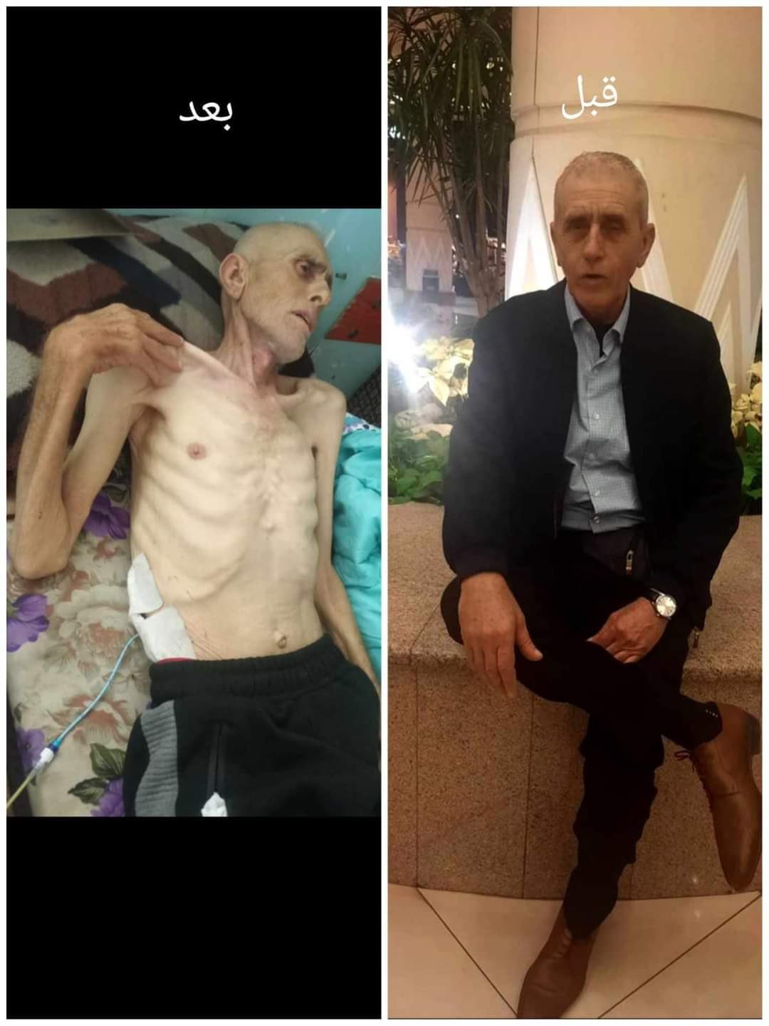 Uncle Mahmoud Shabat urgently needs medical assistance and support