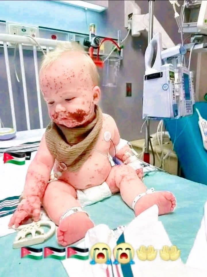 Democracy’s Scars: Lessons from Gaza’s Suffering Children