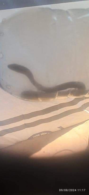 Palestinians in Gaza shelters face dangerous insects and creatures