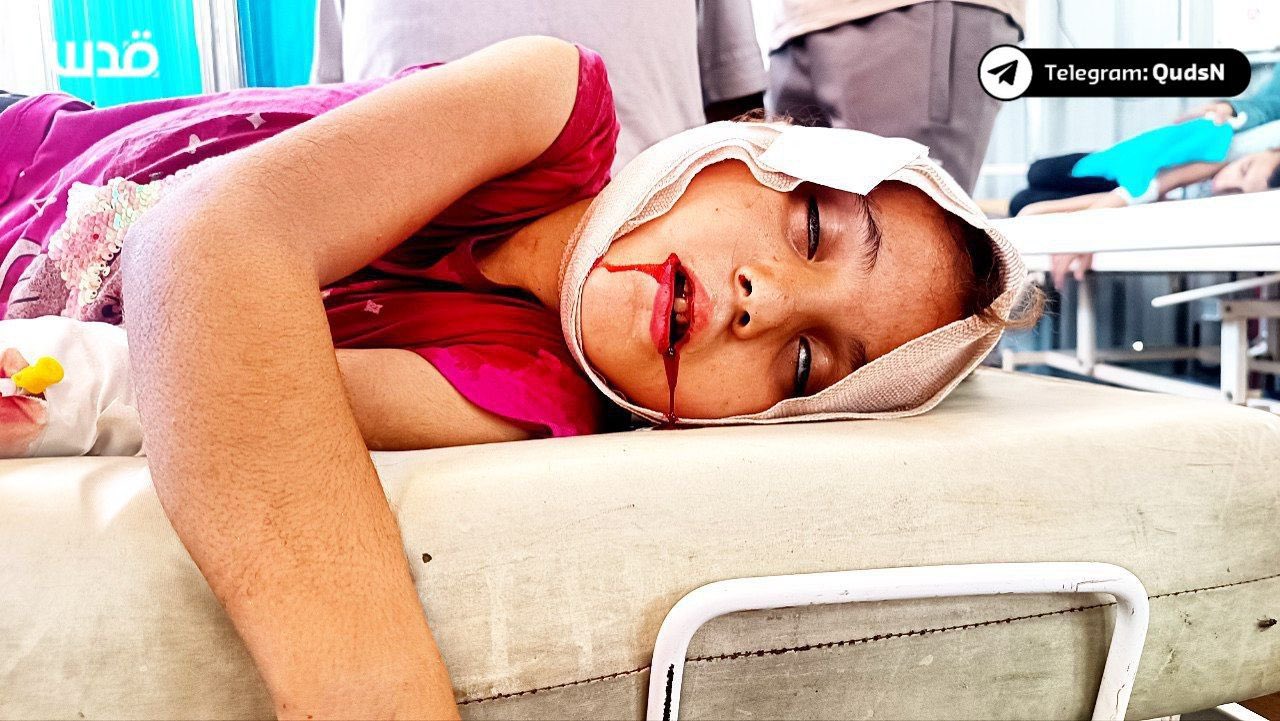 Palestinian child critically injured in Gaza City bombing