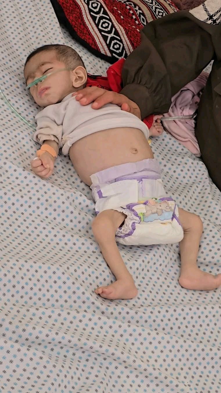 Baby dies from malnutrition at Gaza hospital amid aid blockade
