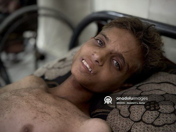 Health Crisis: Zanoun Family Medical Conditions in Gaza