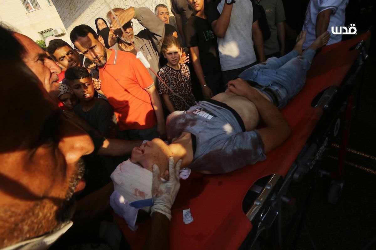 Israeli bombardment causes casualties at Gaza hospital