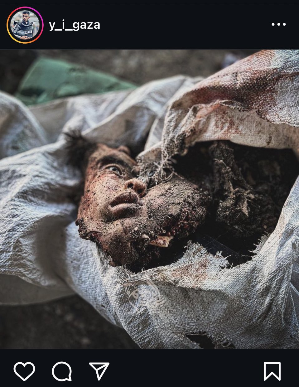 Child killed in Gaza Sheikh Redwan neighborhood