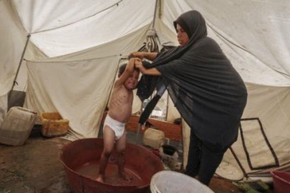 Displaced Palestinian Mother Washes Son with Scarce Water in Gaza