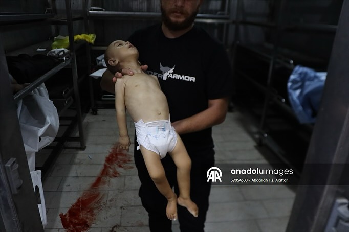 Child Dies from Malnutrition Amid Gaza Healthcare Crisis