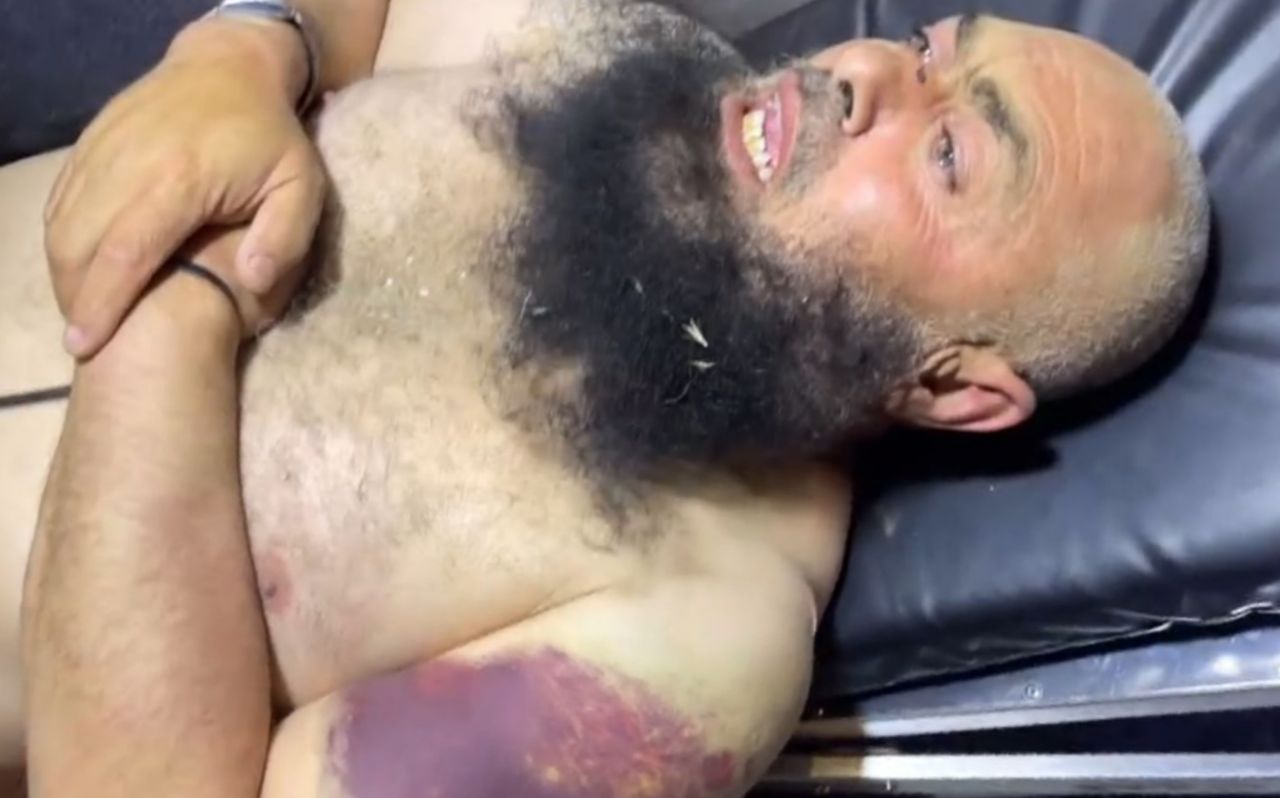 Israeli forces assault elderly Palestinian during arrest raid in Dura