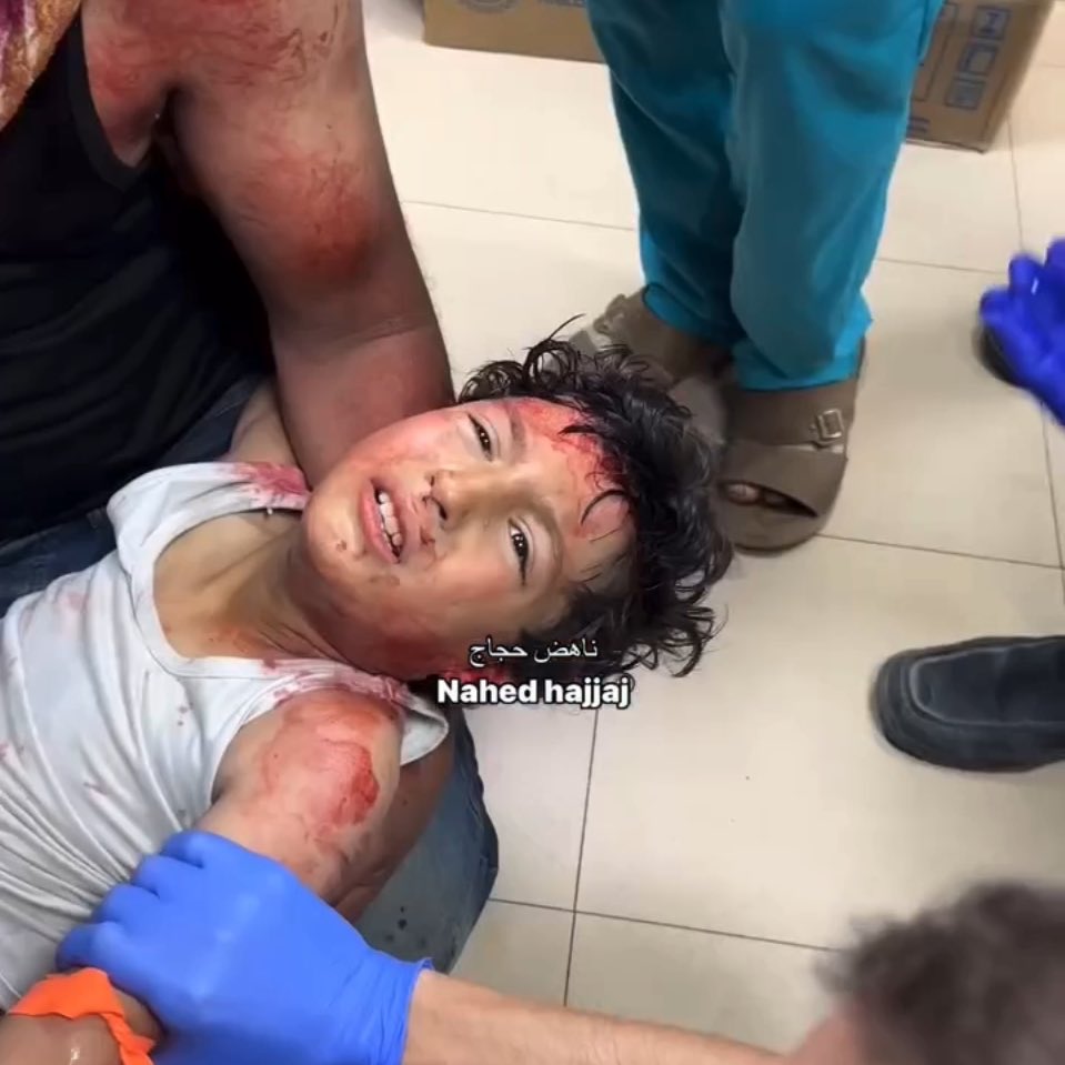 Child rescued from Israeli airstrike rubble in Deir al-Balah
