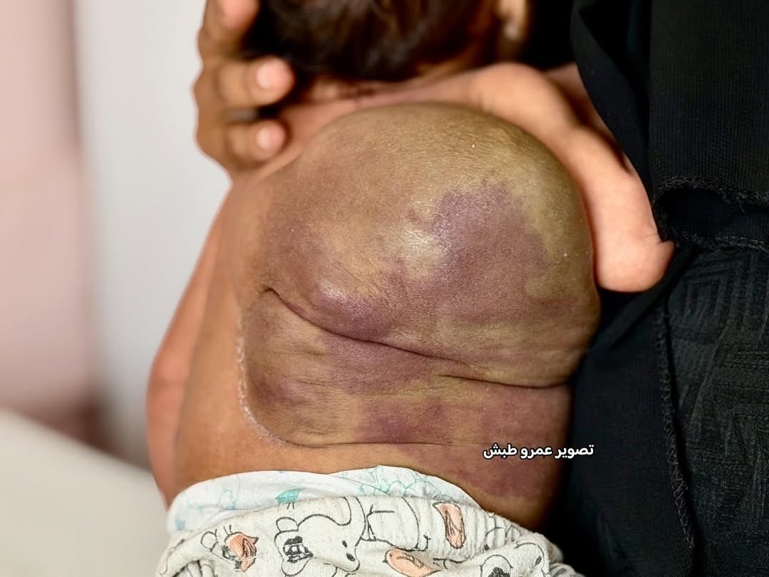 Baby Habiba Abu Radwan needs immediate medical evacuation for lifesaving surgery