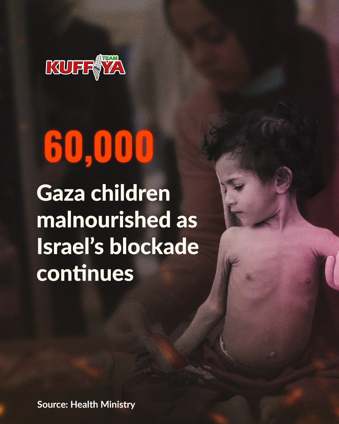 Gaza malnutrition crisis: 60,000 children at severe risk
