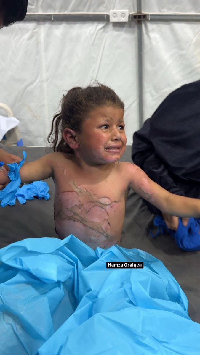 Israeli quadcopter strike wounds civilians in Gaza City