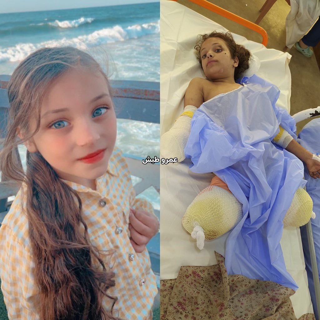 Family killed in Gaza airstrike, limbs amputated