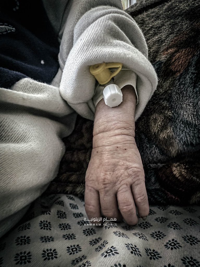 Palestinian Health Director Warns of Famine Crisis and Healthcare Access Barriers