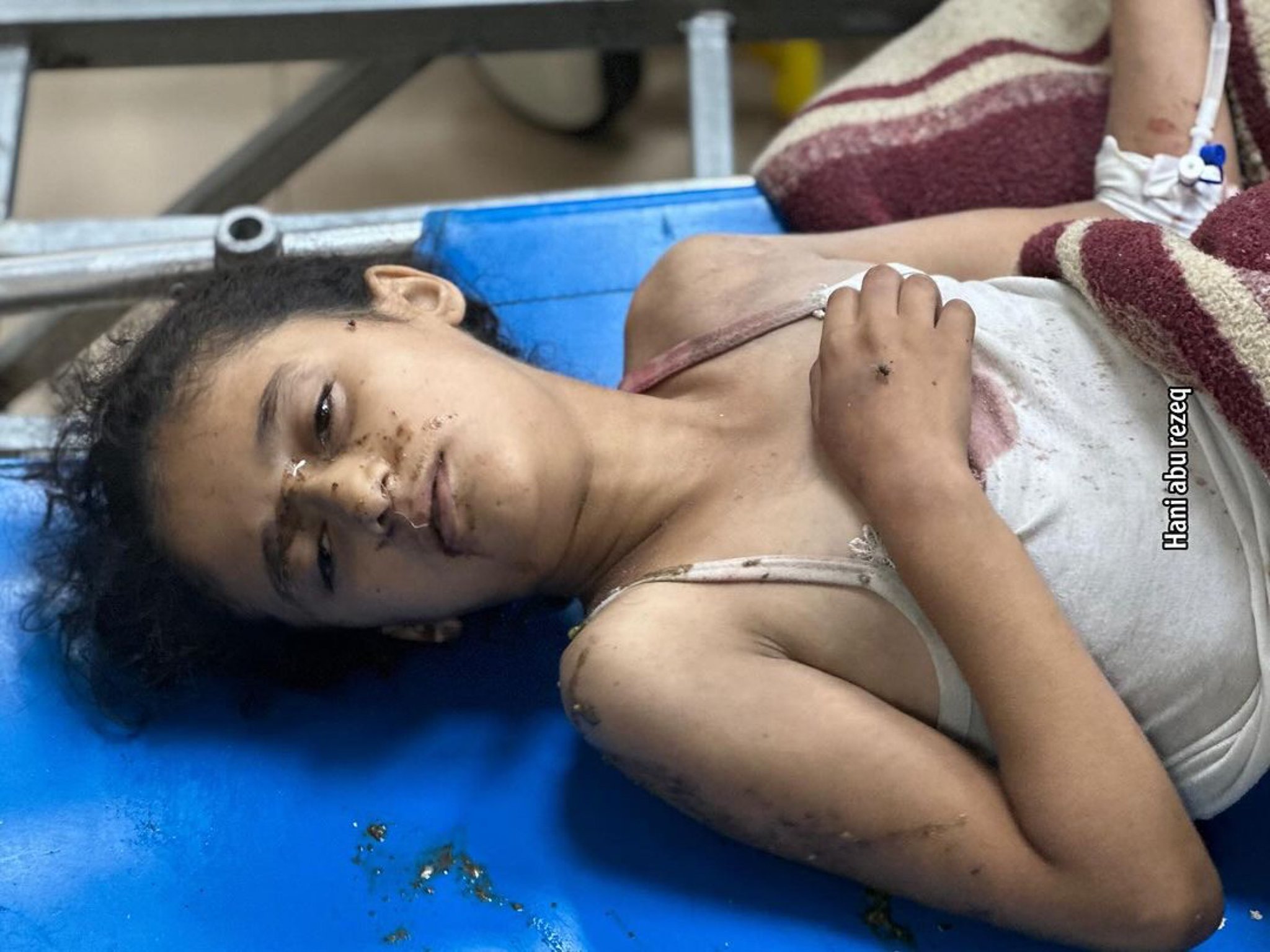 Gaza’s Sole Survivor: Young Liyan Lost Her Twin Sister