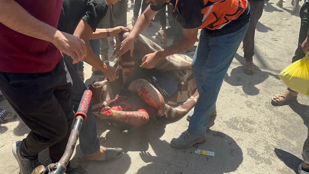 Seven Killed in Israeli Bombing North Gaza City