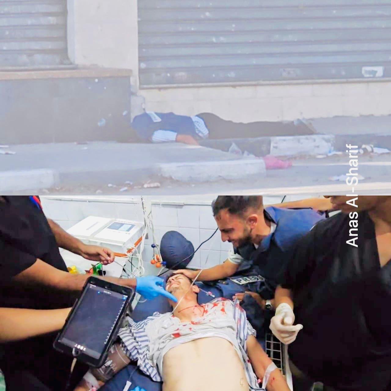 Al Jazeera Cameraman Wounded in Israeli Shooting Jabalia