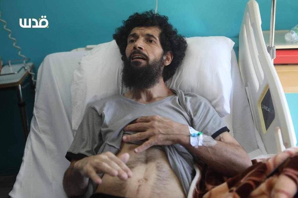 Palestinian Prisoner Mu’azzaz Abayat Receives Medical Care After Torture